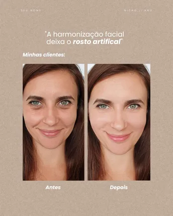 Post do feed Elegance, modelo 2